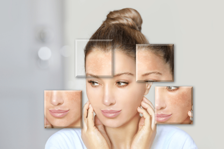 Electrolytes, Water, and Skin Health: Do You Need All Three - Alkalife